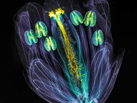  Flabellula: Een Microscopische Wonder van Blobbende Beweging en Verrassende Voeding!