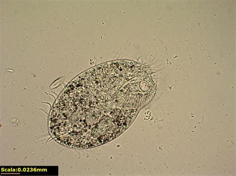  Oxytricha: Een Microscopische Wonder dat zich Gedraagt als een Paramecium met een Turbocharger!