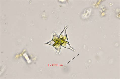  Staurastrum: Een Microscopische Meester van Geometrie en Waterleven!